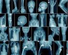 surgery-image