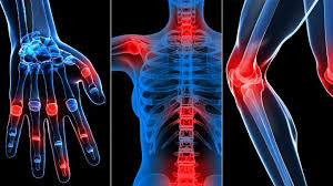 surgery-image
